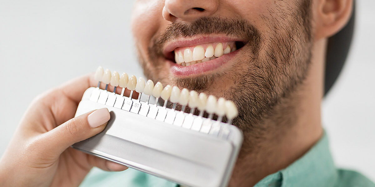 Friendly-Family-Dentistry-Veneers-Blog-01-2020