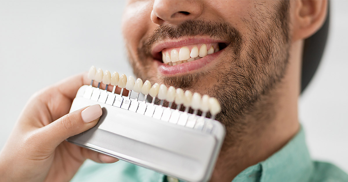 Friendly-Family-Dentistry-Veneers-Blog-01-2020