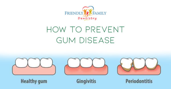 blog – haring – how to prevent gum disease – dec- 1200 x 630
