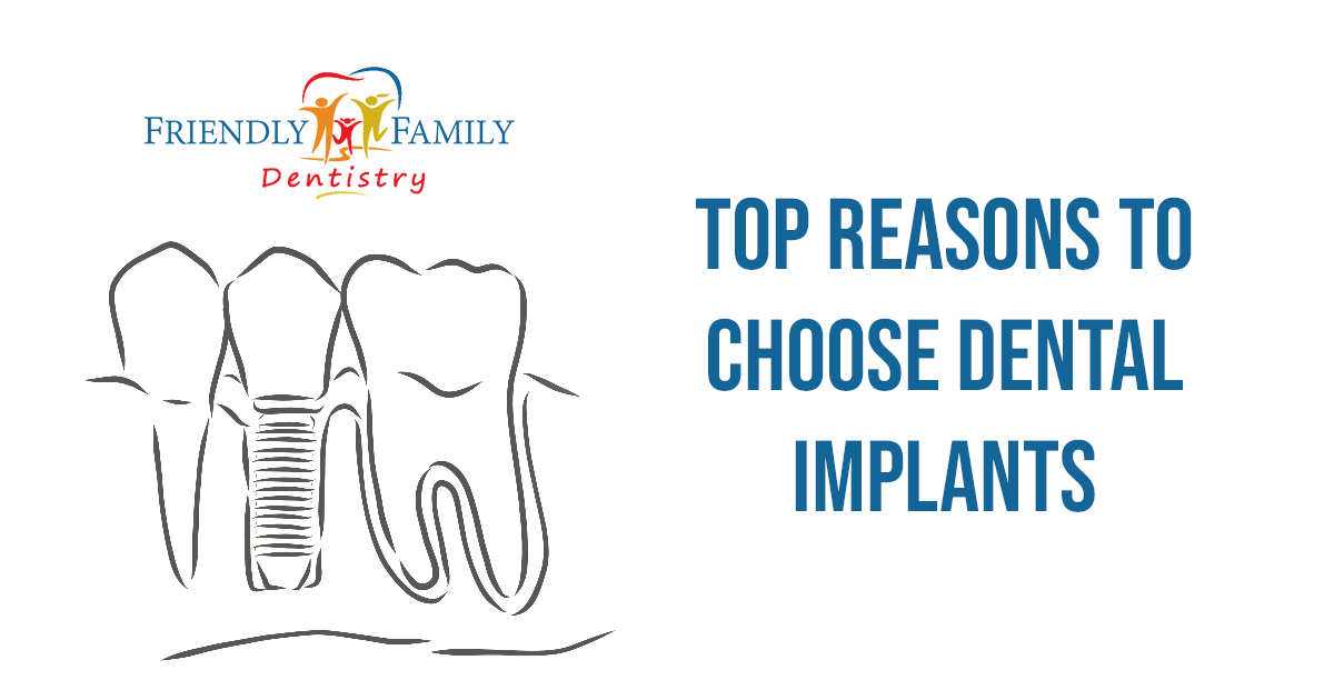 Haring – blog – top reasons to choose dental implants – 1200 x 630