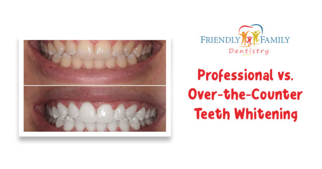 Haring – email – professional vs over the counter teeth whitening – 1200 x 630