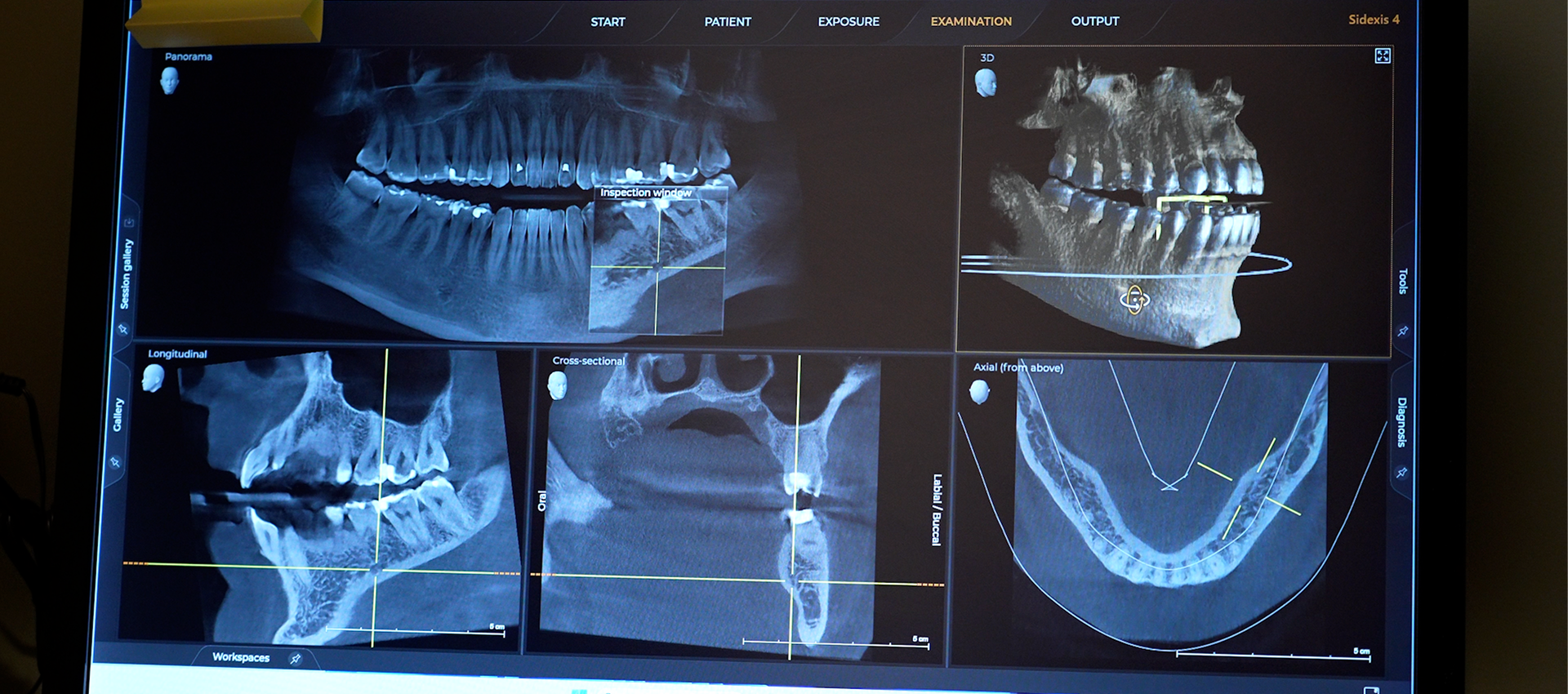 digital radiography